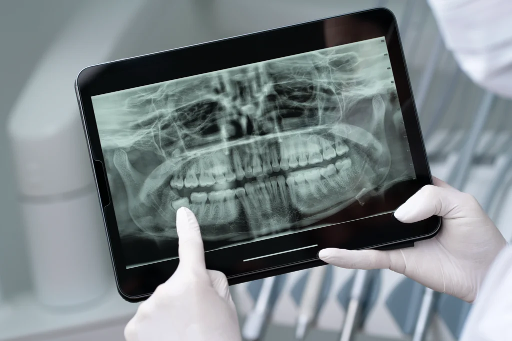 Radiologie numérique : imagerie dentaire de précision