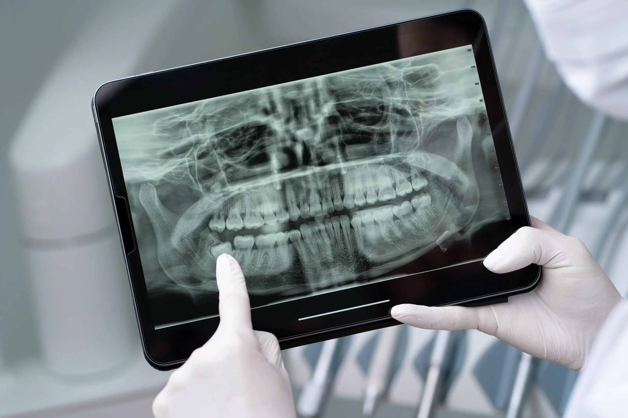 Radiologie numérique